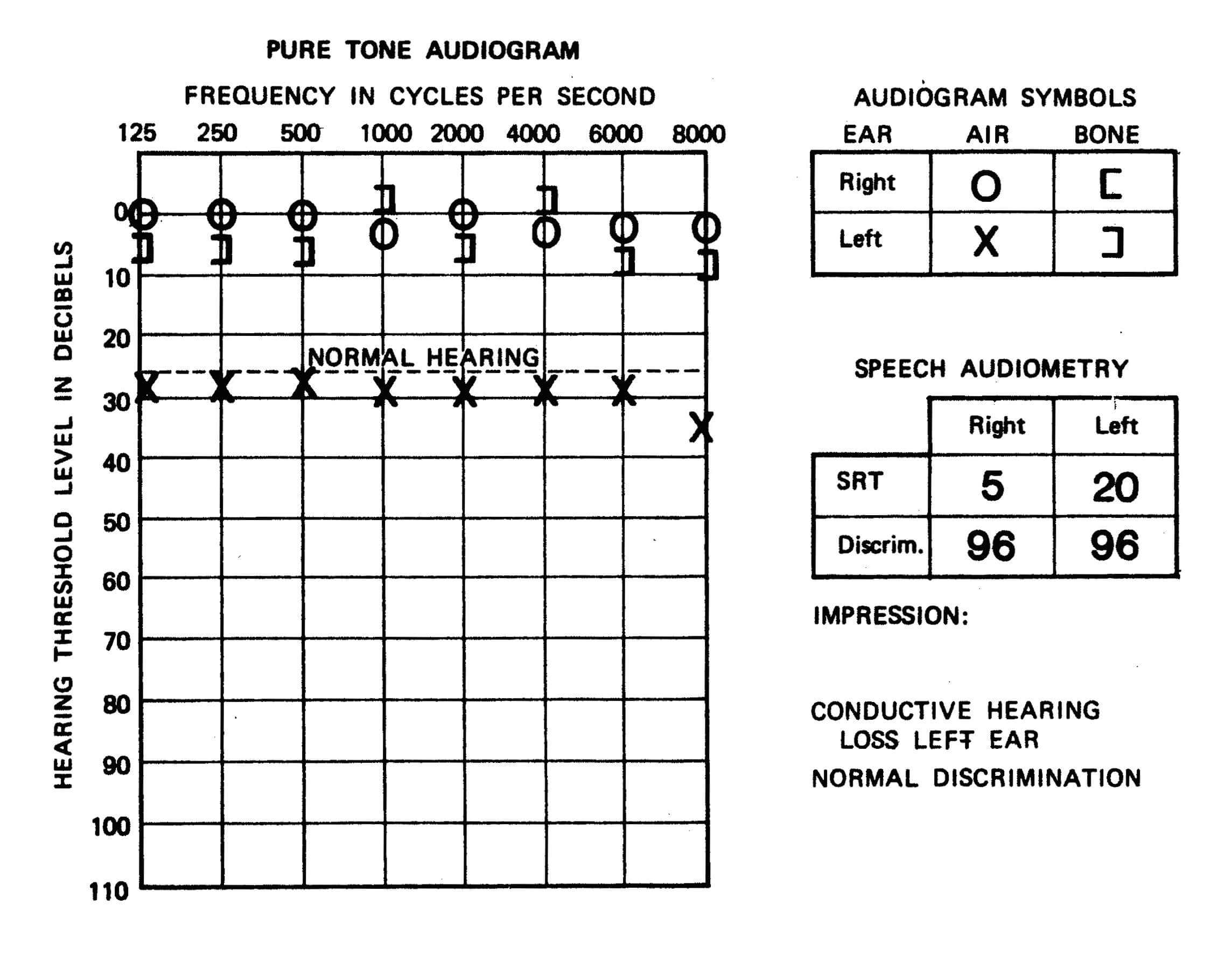 blank-audiogram-template-download