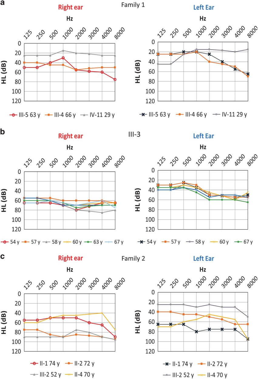 Air Conduction Audiograms. (A) Family 1 Show A Severe In Blank Audiogram Template Download