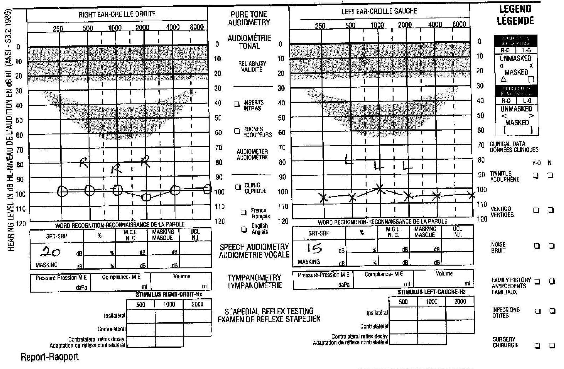 Blank Audiogram Template Download – Atlantaauctionco Regarding Blank Audiogram Template Download