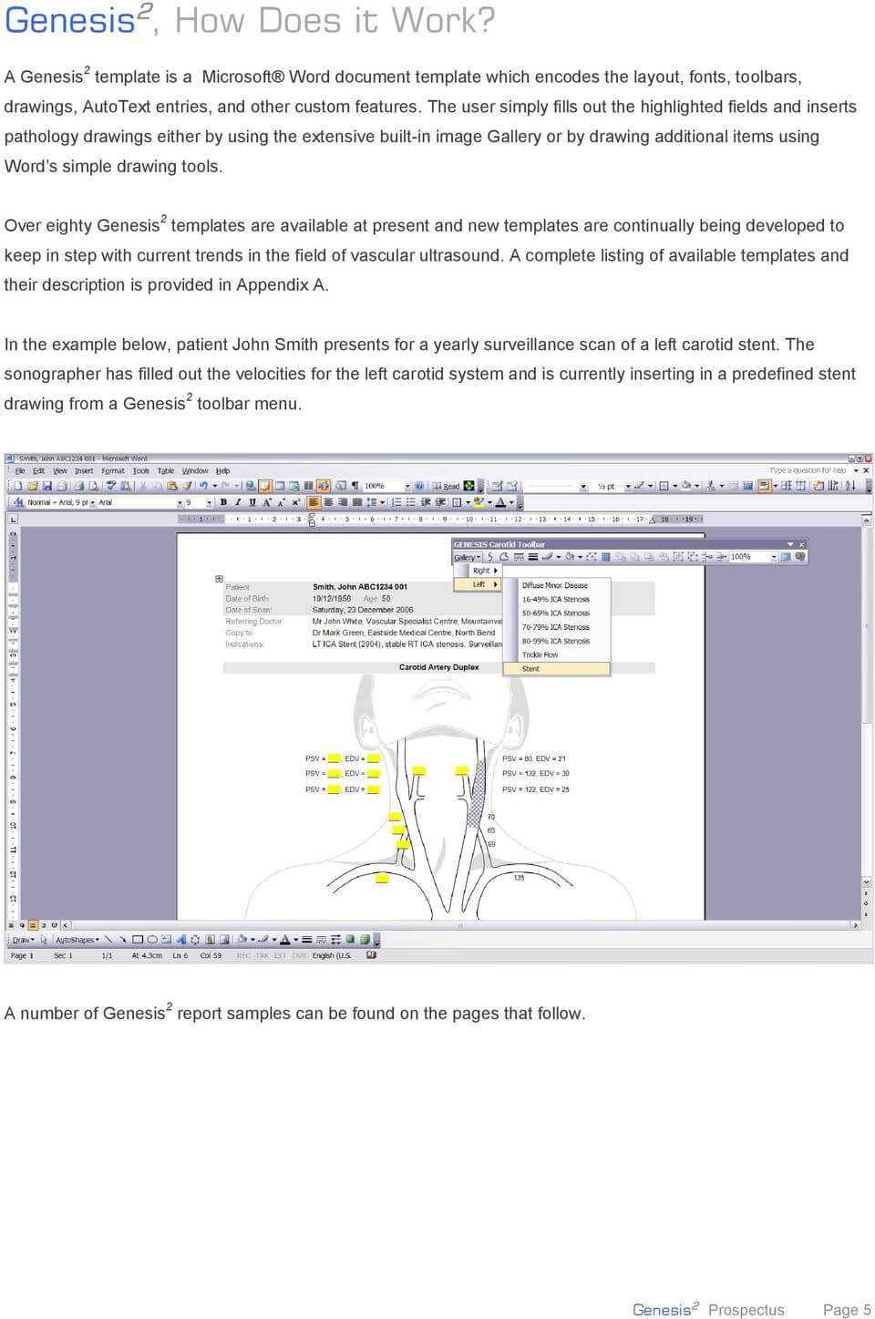 Genesis 2 System For Reporting Of Vascular Laboratory Within Carotid Ultrasound Report Template