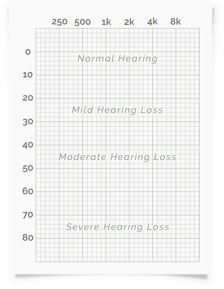Online Hearing Test & Audiogram Printout With Regard To Blank Audiogram Template Download